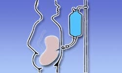 dialysis