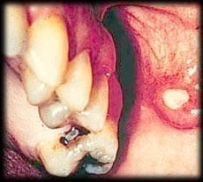 tooth