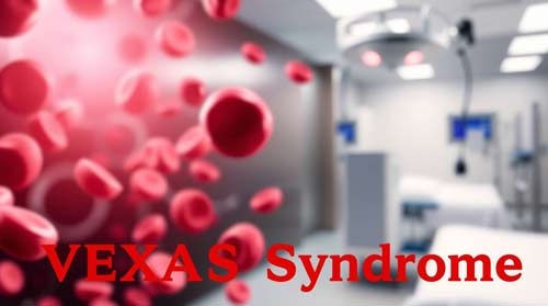 Vexas Syndrome